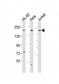 DIP2A Antibody - All lanes : Anti-DIP2A Antibody at 1:1000-1:2000 dilution Lane 1: HL-60 whole cell lysates Lane 2: HeLa whole cell lysates Lane 3: Jurkat whole cell lysates Lysates/proteins at 20 ug per lane. Secondary Goat Anti-Rabbit IgG, (H+L), Peroxidase conjugated at 1/10000 dilution Predicted band size : 170 kDa Blocking/Dilution buffer: 5% NFDM/TBST.