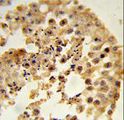 Dipeptidylpeptidase 8 / DPP8 Antibody - Formalin-fixed and paraffin-embedded human testis tissue reacted with DPP8 Antibody , which was peroxidase-conjugated to the secondary antibody, followed by DAB staining. This data demonstrates the use of this antibody for immunohistochemistry; clinical relevance has not been evaluated.