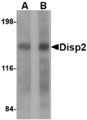 DISP2 Antibody - Western blot of Disp2 in rat brain tissue lysate with Disp2 antibody at (A) 1 and (B) 2 ug/ml
