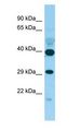 DJ858B16.2 / PISD Antibody - DJ858B16.2 / PISD antibody Western Blot of Fetal Brain.  This image was taken for the unconjugated form of this product. Other forms have not been tested.