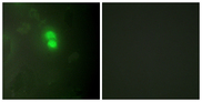 DKC1 / Dyskerin Antibody - Immunofluorescence analysis of HeLa cells, using Dyskerin Antibody. The picture on the right is blocked with the synthesized peptide.