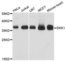 DKK1 Antibody - Western blot analysis of extracts of various cell lines, using DKK1 antibody at 1:1000 dilution. The secondary antibody used was an HRP Goat Anti-Rabbit IgG (H+L) at 1:10000 dilution. Lysates were loaded 25ug per lane and 3% nonfat dry milk in TBST was used for blocking. An ECL Kit was used for detection and the exposure time was 30s.