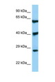 DKK3 Antibody - DKK3 antibody Western blot of 293T Cell lysate. Antibody concentration 1 ug/ml.  This image was taken for the unconjugated form of this product. Other forms have not been tested.
