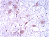 DKK3 Antibody - IHC of paraffin-embedded brain tissues using DKK3 mouse monoclonal antibody with DAB staining.