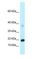 DKK4 Antibody - DKK4 antibody Western Blot of Mouse Pancreas.  This image was taken for the unconjugated form of this product. Other forms have not been tested.