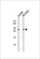 DKK4 Antibody - Western blot of lysates from Jurkat, HUVEC cell line (from left to right), using DKK4 Antibody. Antibody was diluted at 1:1000 at each lane. A goat anti-rabbit IgG H&L (HRP) at 1:5000 dilution was used as the secondary antibody. Lysates at 35ug per lane.