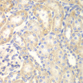 DLC1 Antibody - Immunohistochemistry of paraffin-embedded rat kidney tissue.