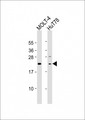DLEU7 Antibody - All lanes: Anti-DLEU7 Antibody (N-Term) at 1:2000 dilution. Lane 1: MOLT-4 whole cell lysate. Lane 2: HuT78 whole cell lysate Lysates/proteins at 20 ug per lane. Secondary Goat Anti-Rabbit IgG, (H+L), Peroxidase conjugated at 1:10000 dilution. Predicted band size: 24 kDa. Blocking/Dilution buffer: 5% NFDM/TBST.