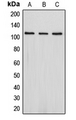 DLG2 / PSD93 Antibody - Western blot analysis of PSD93 expression in Jurkat (A); SHSY5Y (B); HepG2 (C) whole cell lysates.
