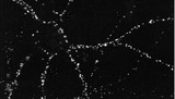 DLG4 / PSD95 Antibody - ICC of PSD95 in cultures of dissociated hippocampal neurons. Cultures were grown and labeled with antibodies against the indicated proteins. A neuron double stained for PSD95.  This image was taken for the unconjugated form of this product. Other forms have not been tested.