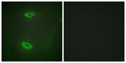 DLGAP1 Antibody - Immunofluorescence analysis of HeLa cells, using DLGP1 Antibody. The picture on the right is blocked with the synthesized peptide.