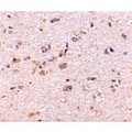 DLGAP1 Antibody - Immunohistochemistry of SAPAP1 in human brain with SAPAP1 antibody at 5 µg/mL.