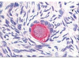 DLL4 Antibody - Anti-Delta-4 Antibody - Immunohistochemistry. Affinity Purified anti-Delta-4 antibody was used at 20 ug/ml to detect Delta-4 in a variety of tissues including colon, liver, skeletal muscle, ovary, pancreas, prostate, testes, thymus, tonsil and uterus. In contrast to reported findings, no staining was observed in vascular tissue. This image shows Delta-4 staining of human ovary. Tissue was formalin-fixed and paraffin embedded. Personal Communication, Tina Roush, LifeSpanBiosciences, Seattle, WA.