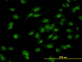 DLX1 Antibody - Immunofluorescence of monoclonal antibody to DLX1 on HeLa cell. [antibody concentration 10 ug/ml]