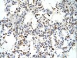 DLX5 Antibody - DLX5 antibody DLX5(distal-less homeobox 5) Antibody was used in IHC to stain formalin-fixed, paraffin-embedded human lung.  This image was taken for the unconjugated form of this product. Other forms have not been tested.