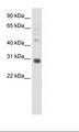 DLX5 Antibody - Placenta Lysate.  This image was taken for the unconjugated form of this product. Other forms have not been tested.