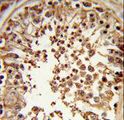 DMC1 Antibody - Formalin-fixed and paraffin-embedded human testis tissue reacted with DMC1 Antibody , which was peroxidase-conjugated to the secondary antibody, followed by DAB staining. This data demonstrates the use of this antibody for immunohistochemistry; clinical relevance has not been evaluated.