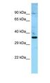 DMC1 Antibody - DMC1 antibody Western Blot of Fetal Heart. Antibody dilution: 1 ug/ml.  This image was taken for the unconjugated form of this product. Other forms have not been tested.