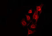 DMPK / DM Antibody - Staining HeLa cells by IF/ICC. The samples were fixed with PFA and permeabilized in 0.1% Triton X-100, then blocked in 10% serum for 45 min at 25°C. The primary antibody was diluted at 1:200 and incubated with the sample for 1 hour at 37°C. An Alexa Fluor 594 conjugated goat anti-rabbit IgG (H+L) Ab, diluted at 1/600, was used as the secondary antibody.