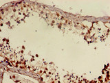 DMRT1 Antibody - Immunohistochemistry of paraffin-embedded human testis tissue using DMRT1 Antibody at dilution of 1:100