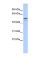 DMRTA1 Antibody - DMRTA1 antibody Western blot of HeLa lysate. This image was taken for the unconjugated form of this product. Other forms have not been tested.