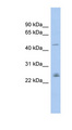 DMRTA3 / DMRT3 Antibody - DMRT3 antibody Western blot of PANC1 cell lysate. This image was taken for the unconjugated form of this product. Other forms have not been tested.