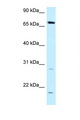DMWD Antibody - DMWD antibody Western blot of MCF7 Cell lysate. Antibody concentration 1 ug/ml.  This image was taken for the unconjugated form of this product. Other forms have not been tested.