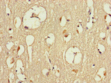 DMXL2 Antibody - Immunohistochemistry of paraffin-embedded human brain tissue at dilution of 1:100