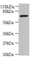 DNA Ligase Antibody - Western blot All lanes: DNA ligase antibody at 2µg/ml + DH5a whole cell lysate Secondary Goat polyclonal to rabbit IgG at 1/10000 dilution Predicted band size: 74 kDa Observed band size: 74 kDa