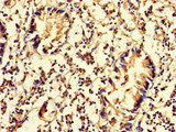 DNAAF3 Antibody - Immunohistochemistry of paraffin-embedded human appendix tissue at dilution of 1:100