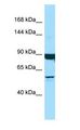 DNAH9 Antibody - DNAH9 antibody Western Blot of Placenta.  This image was taken for the unconjugated form of this product. Other forms have not been tested.