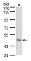 DNAJA2 Antibody - Sample (30 ug of whole cell lysate). A: A431 . 7.5% SDS PAGE. DNAJA2 antibody diluted at 1:500