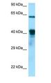 DNAJA3 / TID1 Antibody - DNAJA3 / TID1 antibody Western Blot of Jurkat.  This image was taken for the unconjugated form of this product. Other forms have not been tested.