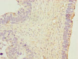 DNAJB1 / Hsp40 Antibody - Immunohistochemistry of paraffin-embedded human prostate tissue using DNAJB1 Antibody at dilution of 1:100
