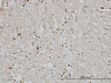 DNAJB2 Antibody - Immunoperoxidase of monoclonal antibody to DNAJB2 on formalin-fixed paraffin-embedded human lateral ventricle wall. [antibody concentration 3 ug/ml]