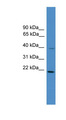 DNAJB4 Antibody - DNAJB4 antibody Western blot of NCI-H226 cell lysate. This image was taken for the unconjugated form of this product. Other forms have not been tested.