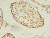DNAJB5 Antibody - Immunohistochemistry of paraffin-embedded human testis using antibody at 1:100 dilution.  This image was taken for the unconjugated form of this product. Other forms have not been tested.