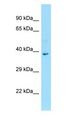 DNAJB7 Antibody - DNAJB7 antibody Western Blot of Fetal Bladder.  This image was taken for the unconjugated form of this product. Other forms have not been tested.