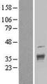 DNAJC17 Protein - Western validation with an anti-DDK antibody * L: Control HEK293 lysate R: Over-expression lysate