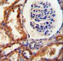 DNAJC22 / FLJ13236 Antibody - DNAJC22 antibody immunohistochemistry of formalin-fixed and paraffin-embedded human kidney tissue followed by peroxidase-conjugated secondary antibody and DAB staining.