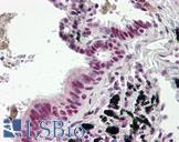 DNAJC3 / p58IPK Antibody - Human Lung, Respiratory Epithelium: Formalin-Fixed, Paraffin-Embedded (FFPE)