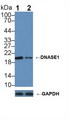 DNASE1 / DNase I Antibody - Knockout Varification: Lane 1: Wild-type 293T cell lysate; Lane 2: DNASE1 knockout 293T cell lysate; Predicted MW: 20,31kDa Observed MW: 20kDa Primary Ab: 2µg/ml Rabbit Anti-Human DNASE1 Antibody Second Ab: 0.2µg/mL HRP-Linked Caprine Anti-Rabbit IgG Polyclonal Antibody