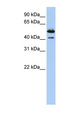 DNASE2B Antibody - DNASE2B antibody Western blot of Placenta lysate. This image was taken for the unconjugated form of this product. Other forms have not been tested.