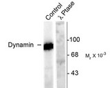 DNM1 / Dynamin Antibody - Western blot of rat hippocampal lysate stimulated with forskolin showing specific immunolabeling of the ~95k dynamin phosphorylated at Ser778 (Control). The phosphospecificity of this labeling is shown in the second lane (lambda-phosphatase: lambda phosph