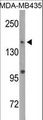 DNMT / DNMT1 Antibody - Western blot of DNMT1 Antibody (S1105) in MDA-MB435 cell line lysates (35 ug/lane). DNMT1 (arrow) was detected using the purified antibody.