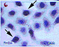 DNMT3A Antibody - Immuno-staining of Dnmt3a using antibody at 5 ug/ml dilution on cultured HeLa cells. The nucleic staining is shown in most of the cells.