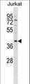 DNMT3L Antibody - DNMT3L Antibody western blot of Jurkat cell line lysates (35 ug/lane). The DNMT3L antibody detected the DNMT3L protein (arrow).