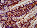 DNPEP Antibody - Immunohistochemistry image at a dilution of 1:600 and staining in paraffin-embedded human small intestine tissue performed on a Leica BondTM system. After dewaxing and hydration, antigen retrieval was mediated by high pressure in a citrate buffer (pH 6.0) . Section was blocked with 10% normal goat serum 30min at RT. Then primary antibody (1% BSA) was incubated at 4 °C overnight. The primary is detected by a biotinylated secondary antibody and visualized using an HRP conjugated SP system.