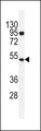 DNTT / TdT Antibody - TdT Antibody western blot of K562 cell line lysates (35 ug/lane). The TdT antibody detected the TdT protein (arrow).