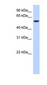 DNTT / TdT Antibody - DNTT / TdT antibody Western blot of Transfected 293T cell lysate. This image was taken for the unconjugated form of this product. Other forms have not been tested.